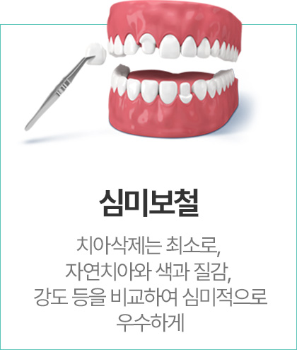 심미보철