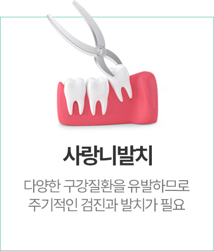 사랑니발치
