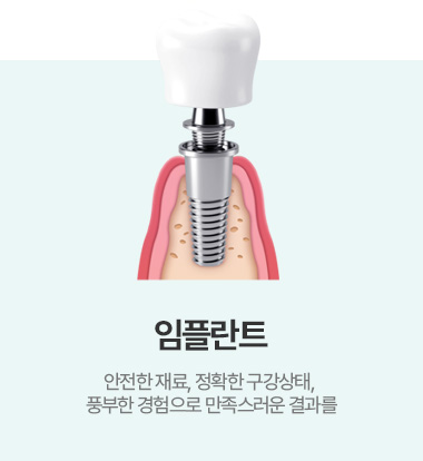 임플란트