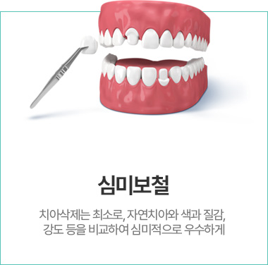 심미보철