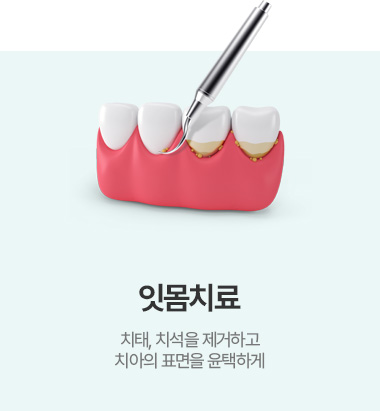 잇몸치료
